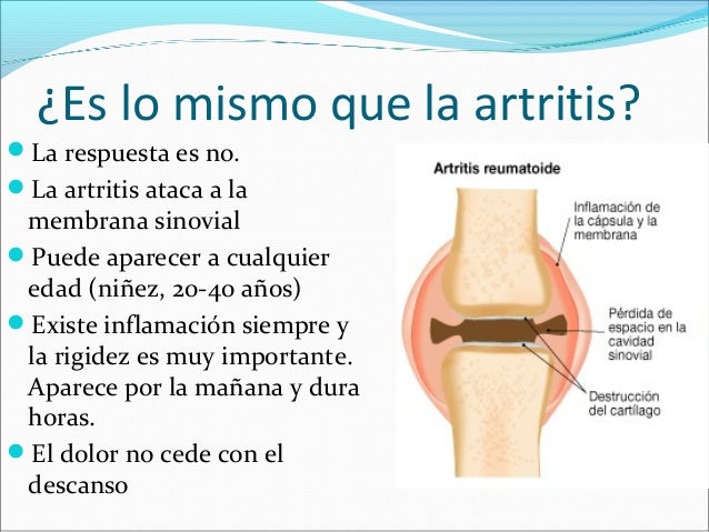 osteoartrosis y osteoartritis es lo mismo